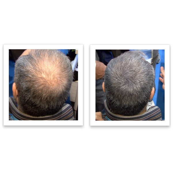 Before and after image of a man with short straight gray hair with a bald spot on his crown