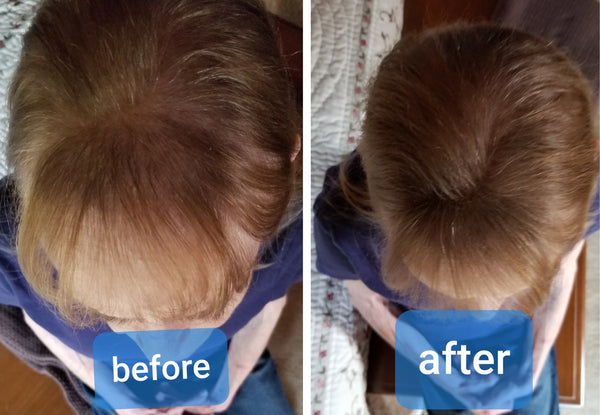 Before and after image of a person with straight brown hair and thin hair on the front and on the crown