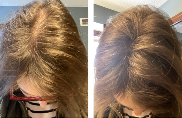 Before and after image of a woman with long straight dark blonde hair with thin hair around her crown