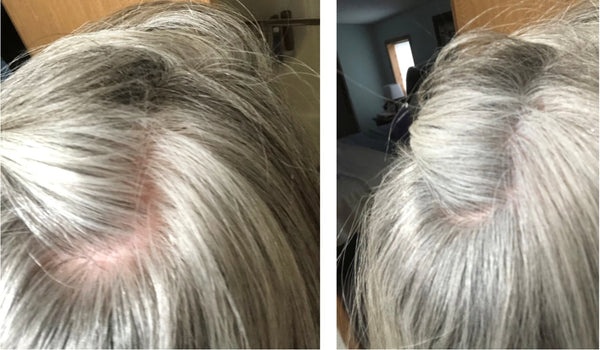 Before and after image of a person with straight silver hair that is thinning on the crown