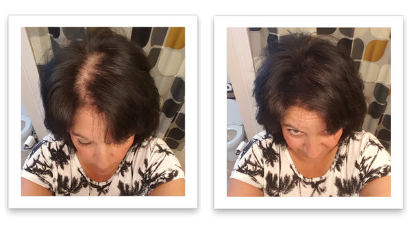 Before and after image of a woman with straight black hair that is thinning on her parting line