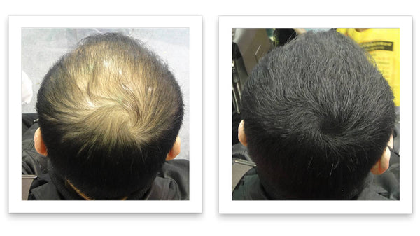 Caboki 10X Hair Powder