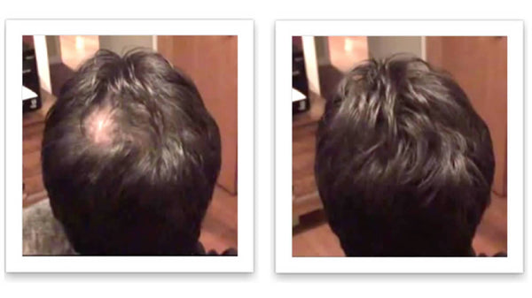Caboki 10X Hair Powder