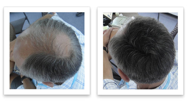 Caboki 10X Hair Powder
