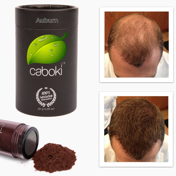 Caboki 30 Gram (90-day supply) **BEST SELLER**