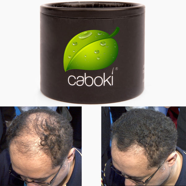 Caboki Free Sample