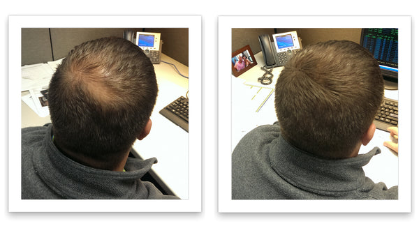 Before and after image of a man with short straight black hair whose hair is thinning across his crown