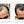 Before and after image of a man with short black hair and thin hair on his frontal scalp