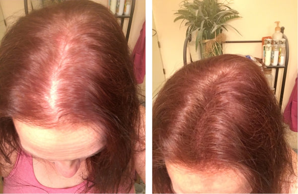Before and after image of a woman with straight reddish-brown hair and thin hair on her parting line