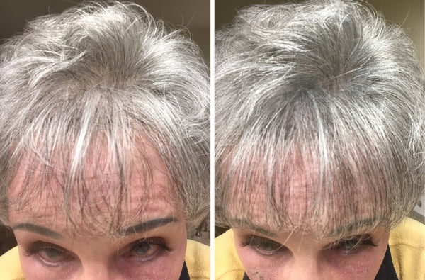 Before and after image of a woman with short wavy white hair which is thinning on the crown