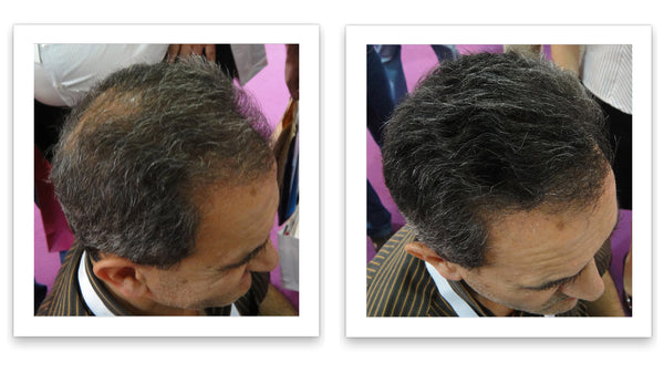 Before and after image of a man with short black hair and a bald spot on his crown
