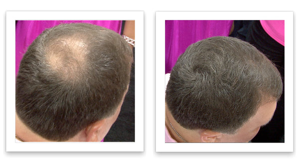 Before and after image of a man with short gray hair and a bald spot on his crown