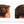 Before and after picture of a man with straight brown hair with a bald spot on the side of his head