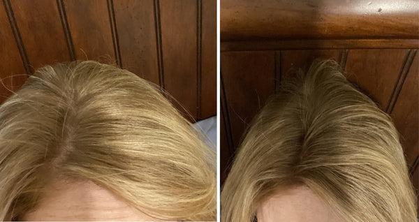 Before and after image of a person with straight blonde hair and thin hair on their parting line