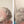 Before and after image of a person with short wavy gray hair and a bald spot on their crown