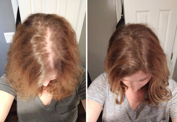 Before and after image of a woman with short wavy light brown hair and thin hair on her parting line