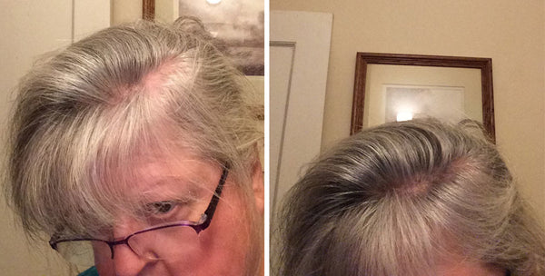 Before and after image of a woman with short straight white hair whose hair is thinning on the parting line