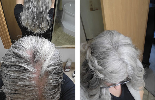 Before and after image of a woman with long wavy white hair and thin hair on her parting line 