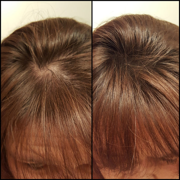 Before and after image of a woman with straight reddish-brown hair and thin hair on her crown