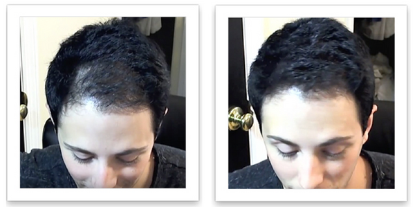 Before and after image of a person with short wavy black hair and has thin hair on the left side of their frontal scalp