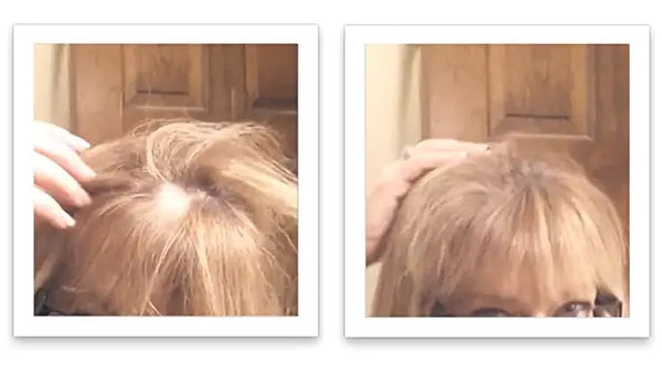 Before and after image of a woman with golden blonde hair with thin hair on her crown