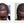 Before and after image of a man with short curly black hair and thin hair around his frontal scalp region