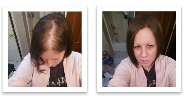 Before and after image of a woman with straight brown hair in a middle part with thin hair along her parting line