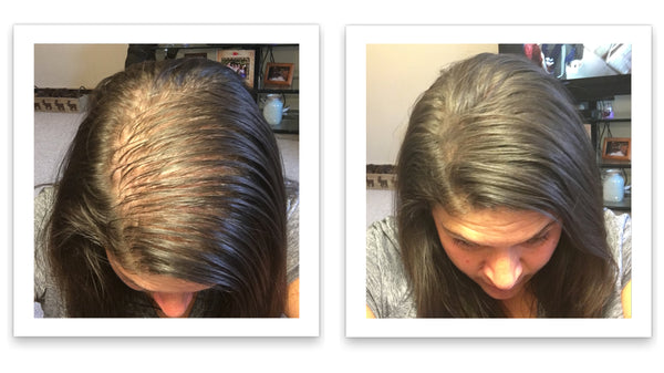 Before and after image of a woman with long straight black hair with thin hair along their parting line and crown