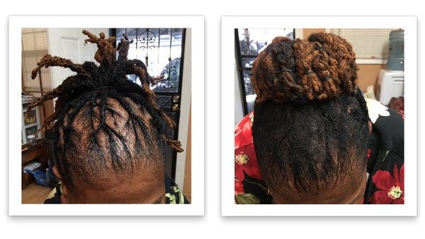 Before and after image of a woman with a black and orange hair and a box braid bun whose hair is thinning on her frontal scalp