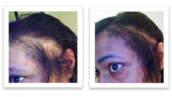 Before and after image of a woman with straight long black hair that is thinning on the side