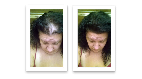 Before and after image of a woman with a middle part with black thin hair on her parting line
